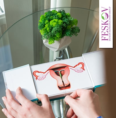 imsi icsi difference