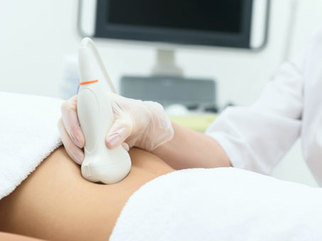 ivf pregnancy