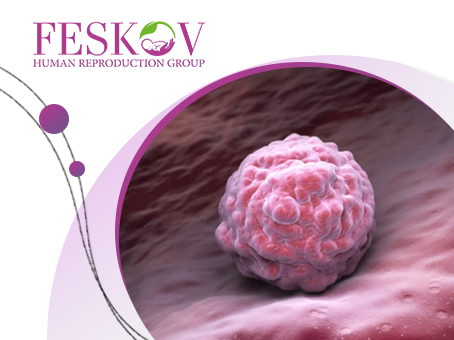 Endometrium Preparation for Embryo Transfer: How does it work picture