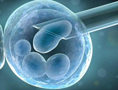 How Artificial Insemination is Carried Out in Humans picture