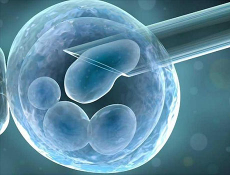How Artificial Insemination is Carried Out in Humans foto How Artificial Insemination is Carried Out in Humans picture