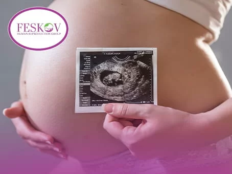 A fertility specialist performs an ultrasound of the fetus to determine the development and sex of the baby in the second trimester of pregnancy.