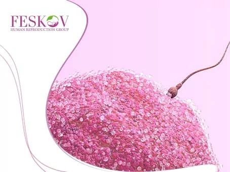 ivf1 ivf1